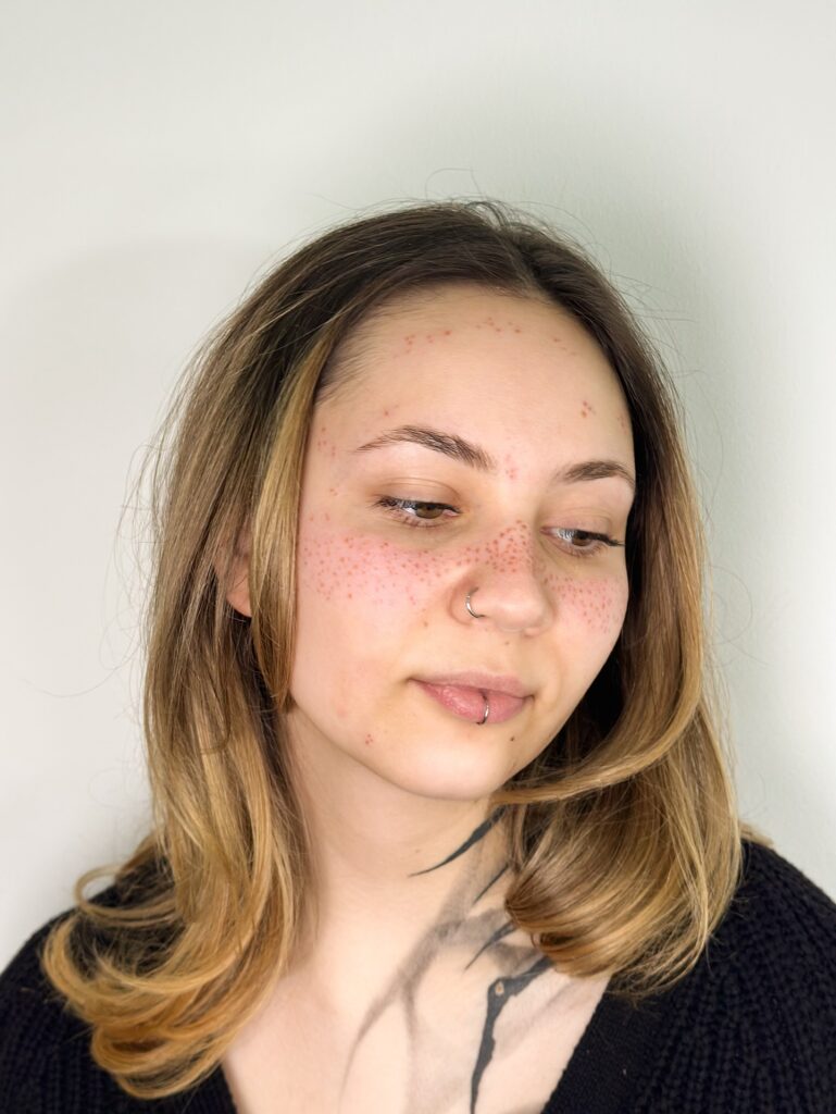 Full Coverage Freckles Tattoo With Natural Density
