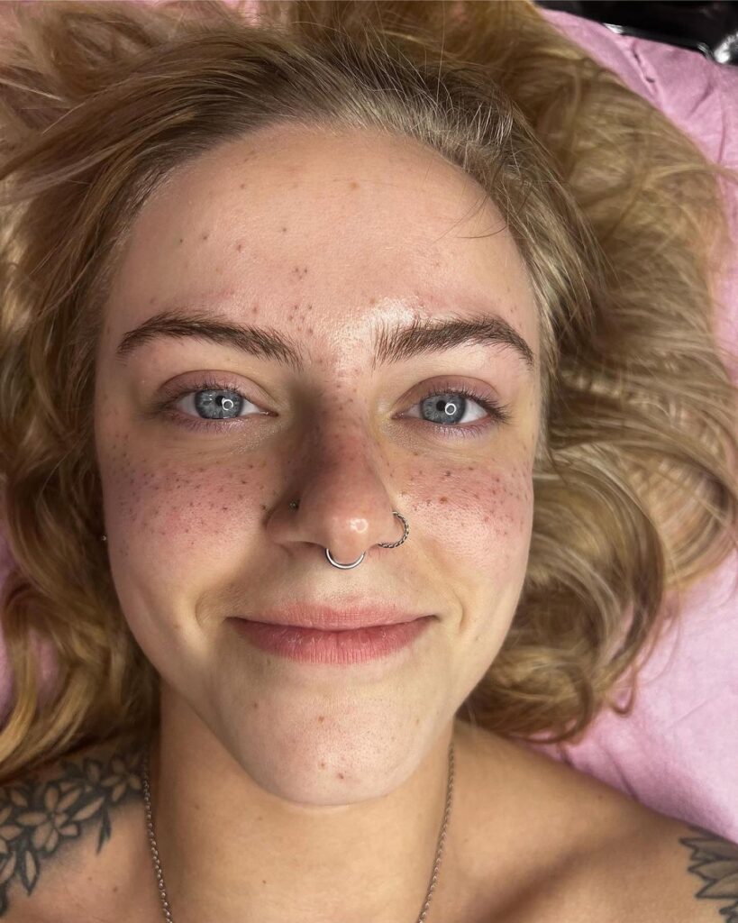Subtle Freckles Tattoo With Balanced Symmetry