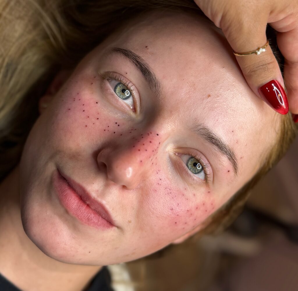 Light And Scattered Freckles Tattoo For A Gentle Glow