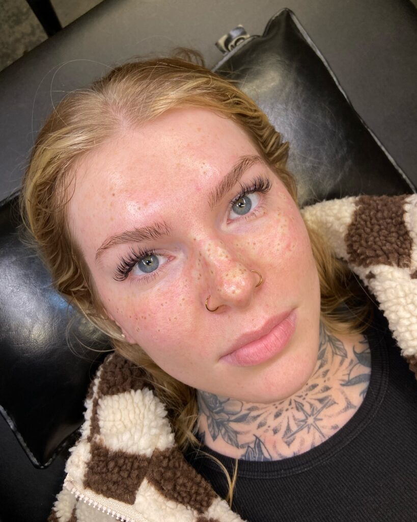 Freshly Inked Freckles Tattoo With Healing Effect