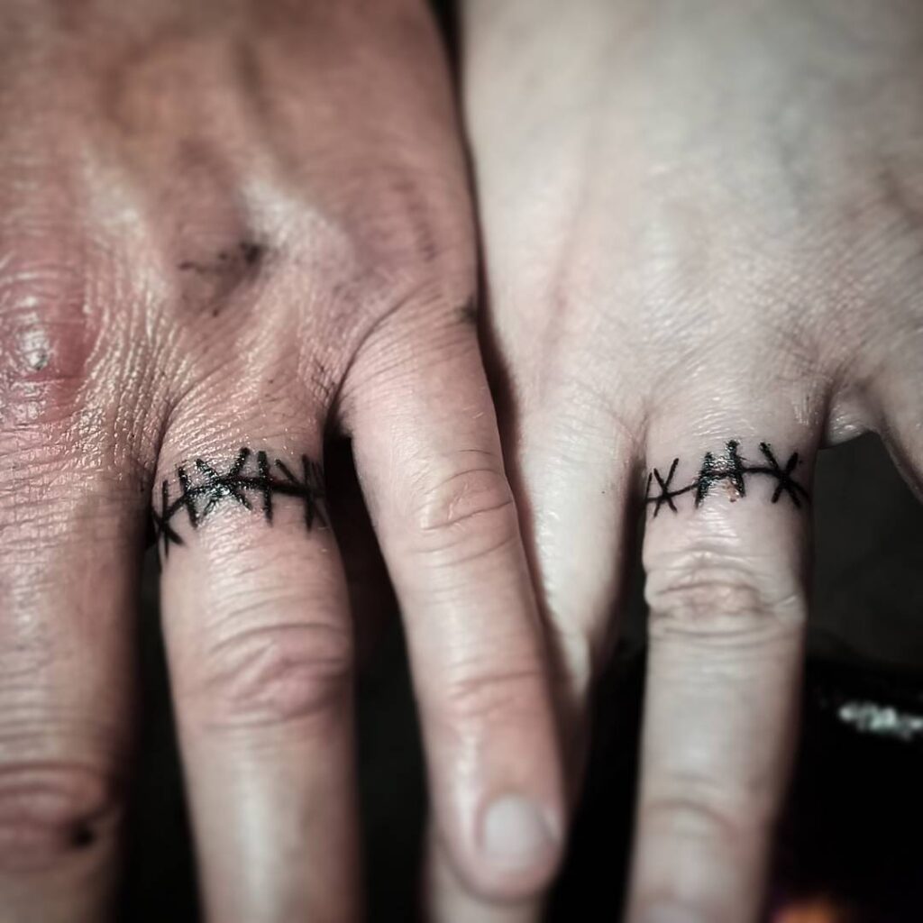 Ring Stitches