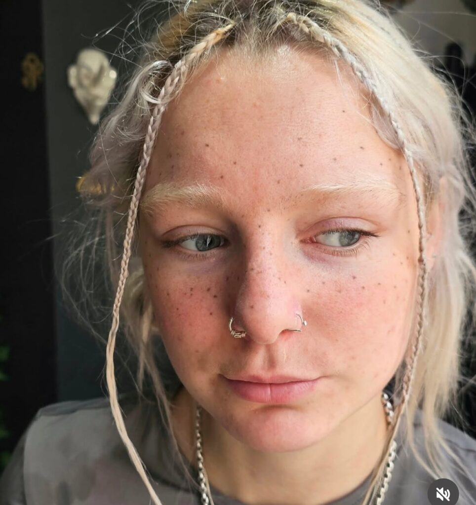 Hand-Poked Natural Freckles Tattoo For Subtle Beauty