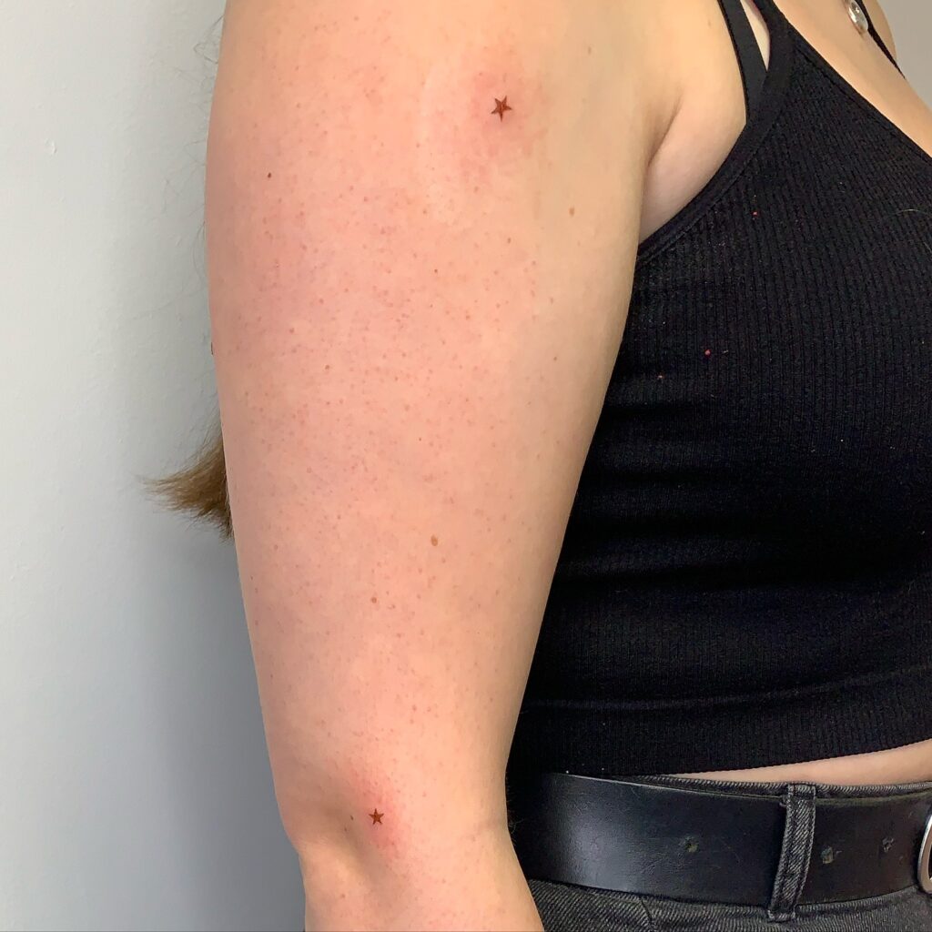 Fresh Bold Freckles Tattoo With Vibrant Contrast